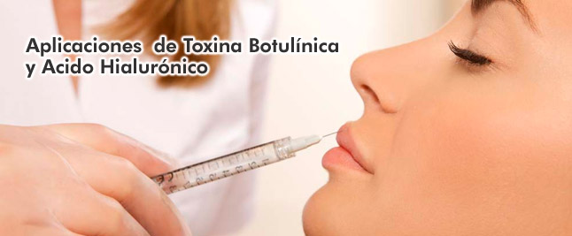 Botox y acido hialuronico
